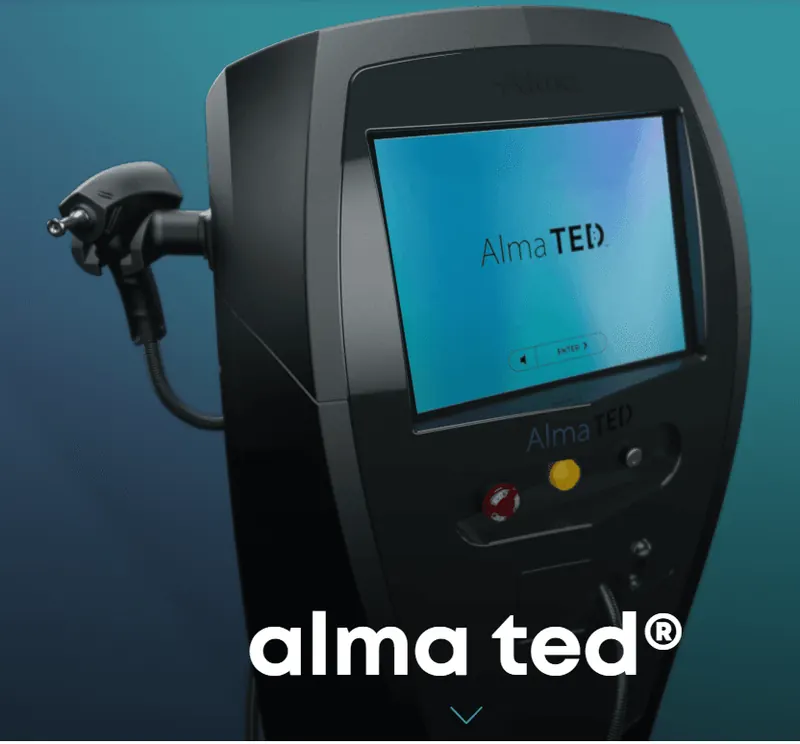 Alma TED Hair Restoration