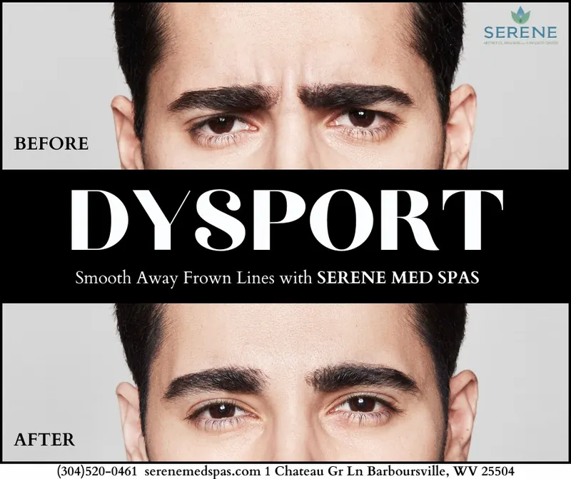 Before and after results of Dysport treatment for forehead wrinkles at Serene Med Spa