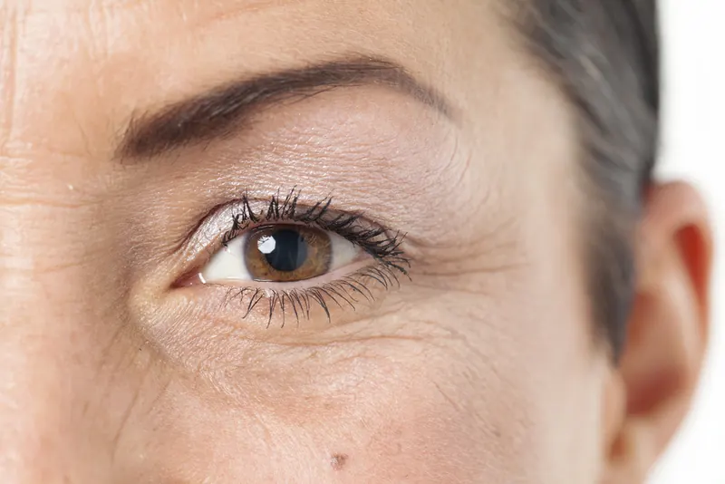 Wrinkles & fine lines