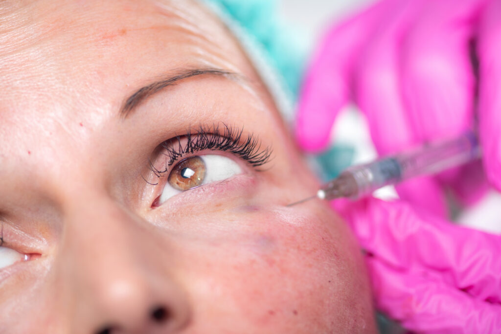 Under-Eye Filler Treatment at Serene Med Spa in Huntington & Barboursville, WV
