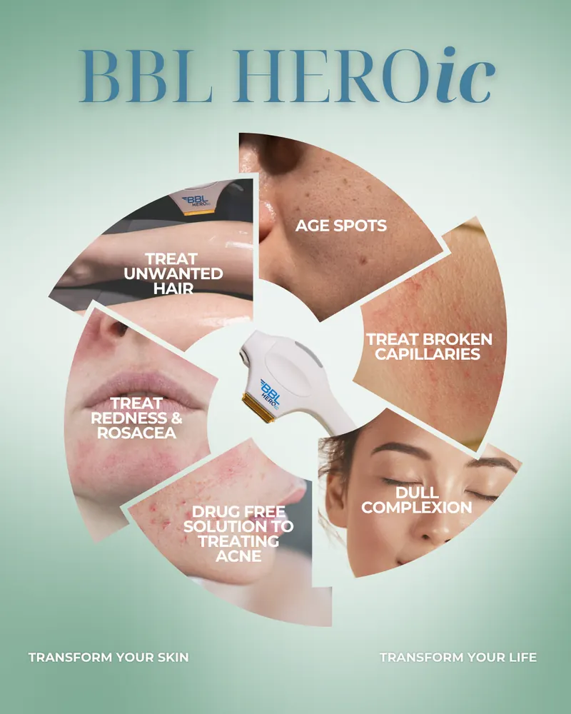 InMode EvolveX Body Contouring