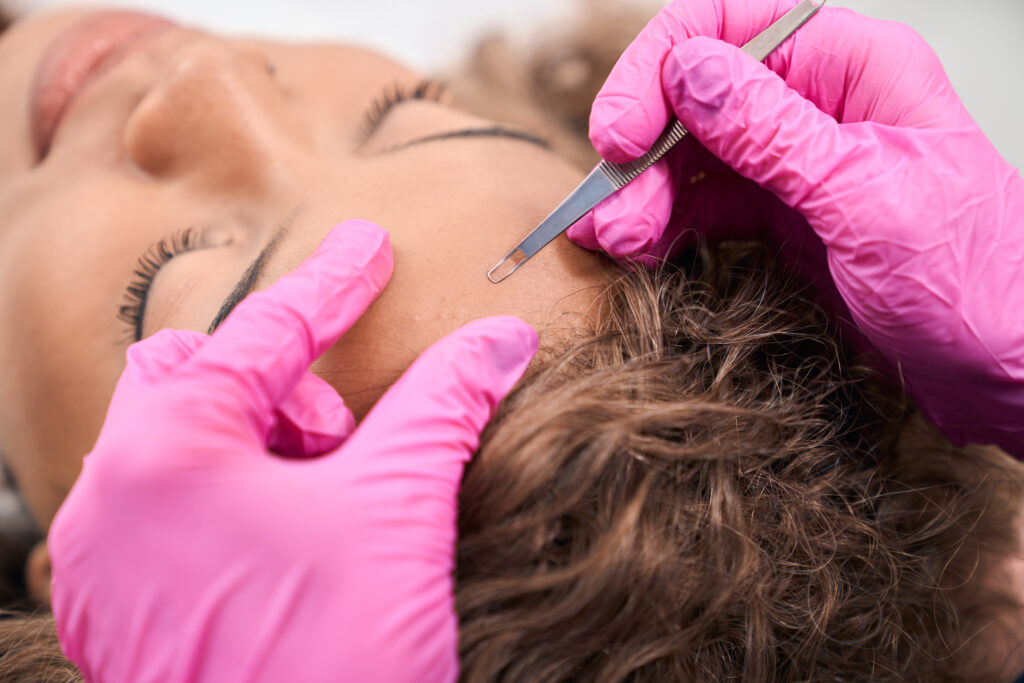 5 Reasons to Try Dermaplaning Facial Treatment in Huntington & Barboursville, WV 5 Reasons to Try Dermaplaning Facial Treatment in Huntington & Barboursville, WV