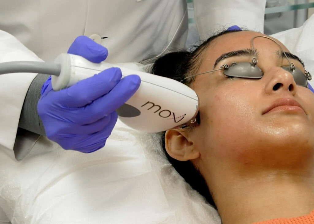 Patient receiving a Sciton MOXI™ Laser revitalization treatment at Serene Med Spa