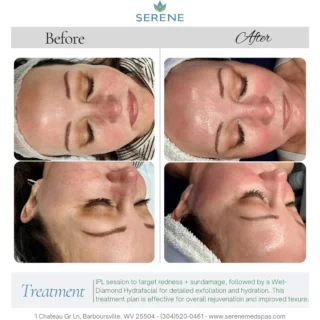Instagram post from serene.wellness.wv. This post is in position 3.
