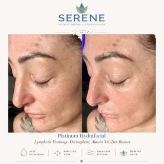Instagram post from serene.wellness.wv. This post is in position 1.