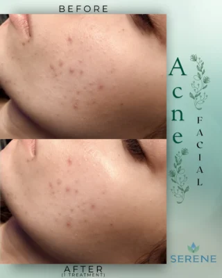 Instagram post from serene.wellness.wv. This post is in position 1.