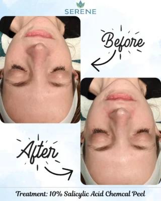 Instagram post from serene.wellness.wv. This post is in position 1.