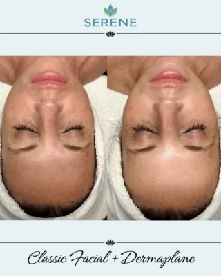 Instagram post from serene.wellness.wv. This post is in position 1.